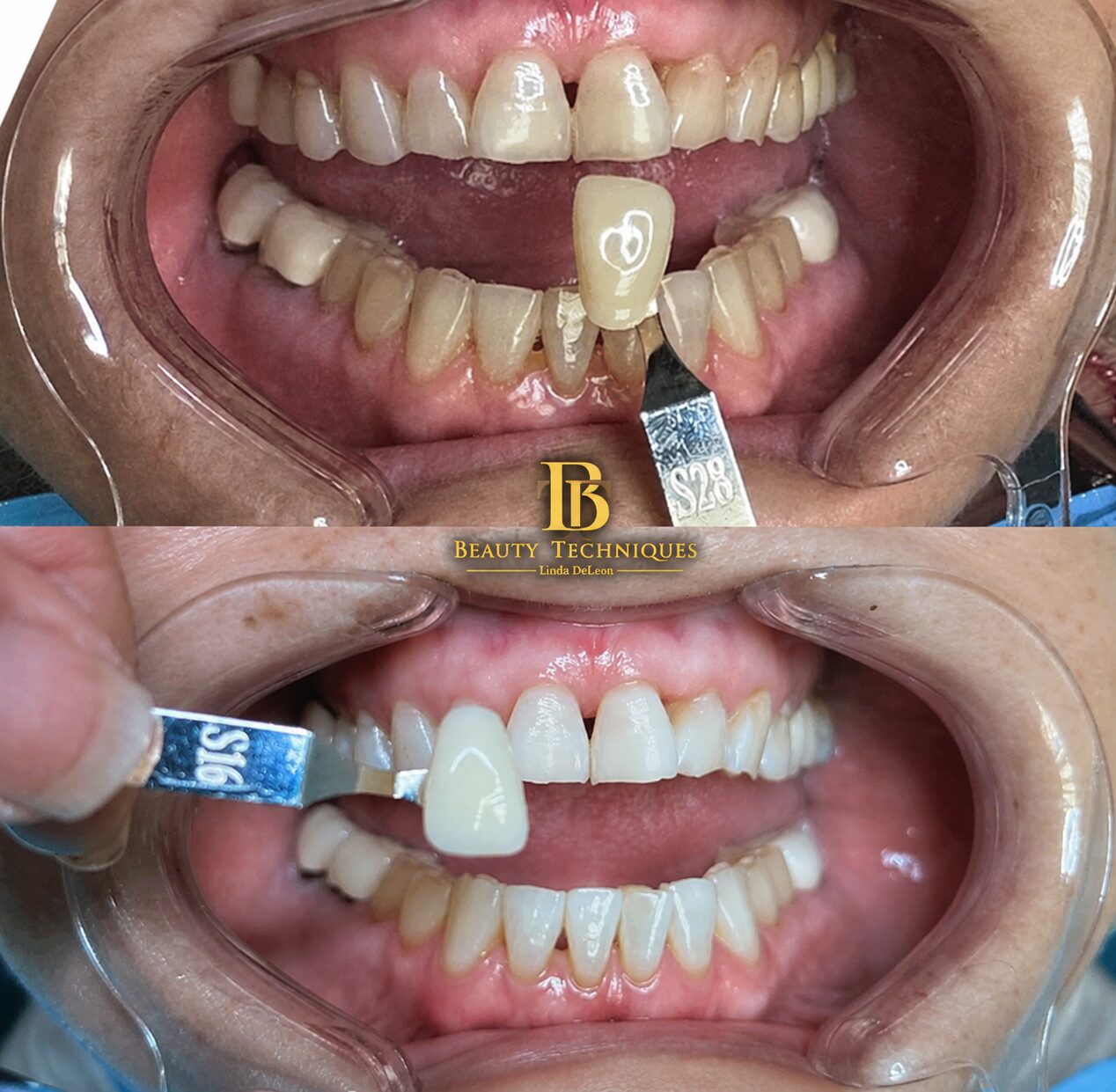 Dental Shade Comparison with Beauty Techniques Logo